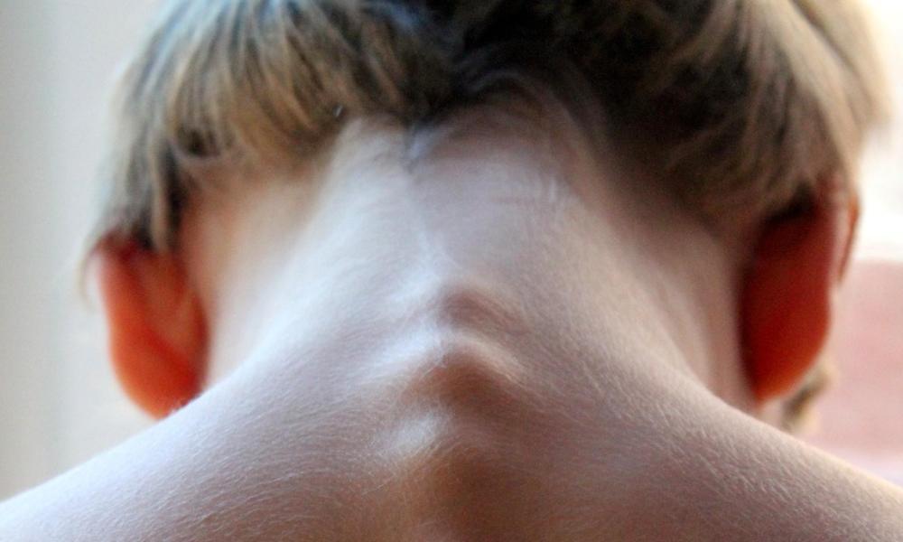 Joga na zdrowy kręgosłup – pozycje polecane przez fizjoterapeutów