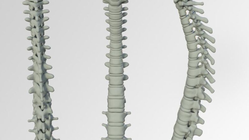 Najlepsze ćwiczenia na ból dolnego odcinka kręgosłupa