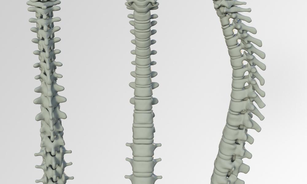 Najlepsze ćwiczenia na ból dolnego odcinka kręgosłupa