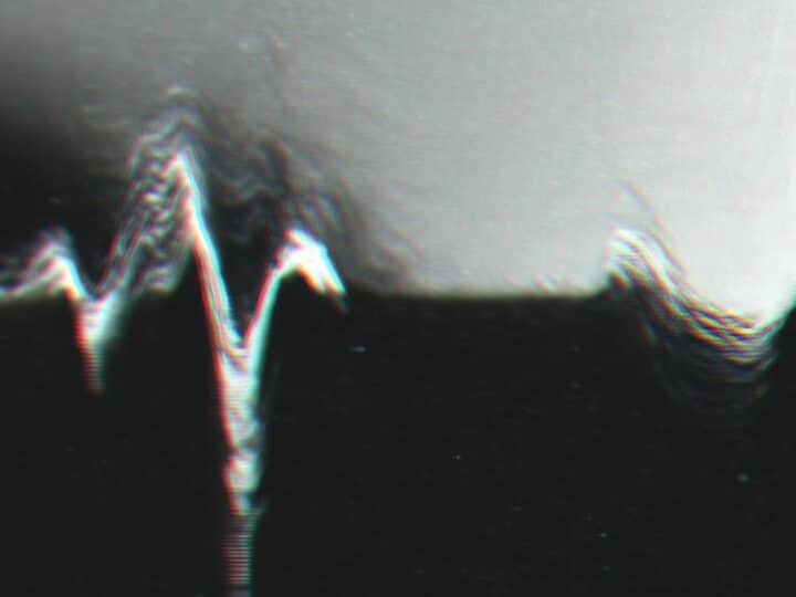 Twoje serce w Twoich rękach: proste kroki do zmniejszenia ryzyka chorób