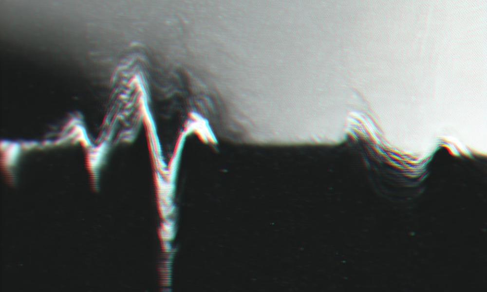 Twoje serce w Twoich rękach: proste kroki do zmniejszenia ryzyka chorób